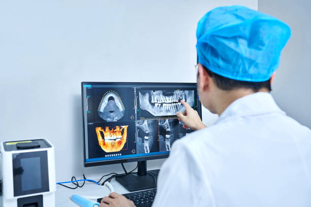 Best Emergency Tooth Extraction in Miller, SD